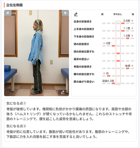 姿勢分析