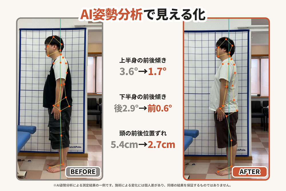 AI姿勢分析で身体を見える化
